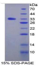 SDS-PAGE (Tgfbr3-298R).jpg